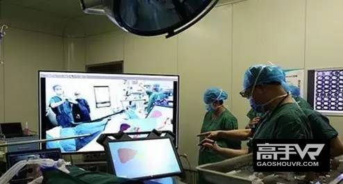 江西首次用VR和3D打印辅助肝脏肿瘤切除